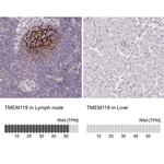 TMEM119 Antibody in Immunohistochemistry (IHC)