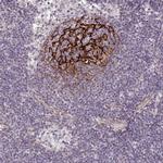 TMEM119 Antibody in Immunohistochemistry (IHC)