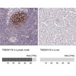 TMEM119 Antibody