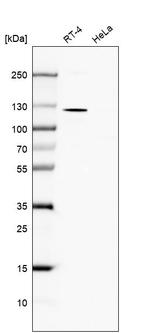 TBC1D2B Antibody in Western Blot (WB)