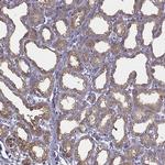 CEL Antibody in Immunohistochemistry (IHC)