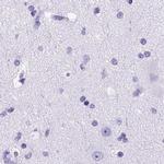 CEL Antibody in Immunohistochemistry (IHC)