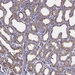 CEL Antibody in Immunohistochemistry (IHC)