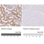 PALM3 Antibody in Immunohistochemistry (IHC)
