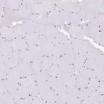 PALM3 Antibody in Immunohistochemistry (IHC)