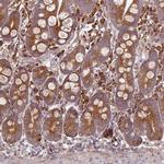 FAT4 Antibody in Immunohistochemistry (IHC)