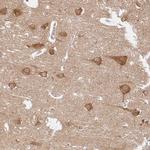 ATP8A1 Antibody in Immunohistochemistry (IHC)