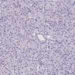 TRIP13 Antibody in Immunohistochemistry (IHC)