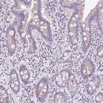 AdoHcyase 3 Antibody in Immunohistochemistry (IHC)