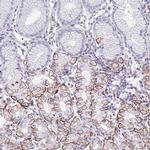 AdoHcyase 3 Antibody in Immunohistochemistry (IHC)