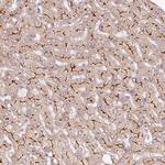 ABCB4 Antibody in Immunohistochemistry (IHC)