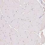 ABCB4 Antibody in Immunohistochemistry (IHC)