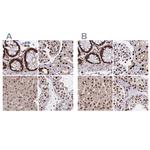 HDGF Antibody in Immunohistochemistry (IHC)