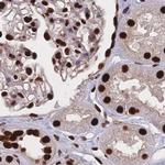 HDGF Antibody in Immunohistochemistry (IHC)