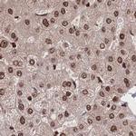 HDGF Antibody in Immunohistochemistry (IHC)