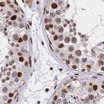 HDGF Antibody in Immunohistochemistry (IHC)