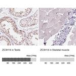 ZC3H14 Antibody