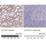 SLC13A1 Antibody