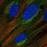 MURF2 Antibody in Immunocytochemistry (ICC/IF)