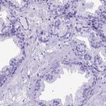 MEOX2 Antibody in Immunohistochemistry (IHC)