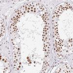 FUSIP1 Antibody in Immunohistochemistry (IHC)