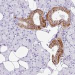 BSND Antibody in Immunohistochemistry (IHC)