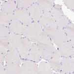 BSND Antibody in Immunohistochemistry (IHC)