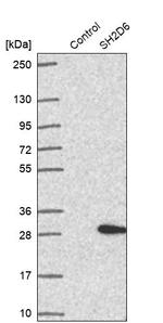 SH2D6 Antibody in Western Blot (WB)