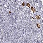 ZP3 Antibody in Immunohistochemistry (IHC)