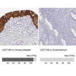 UGT1A6 Antibody in Immunohistochemistry (IHC)