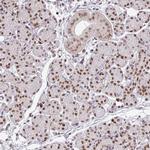 NEIL1 Antibody in Immunohistochemistry (IHC)