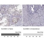 SLCO6A1 Antibody