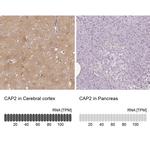 CAP2 Antibody in Immunohistochemistry (IHC)