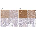 CAP2 Antibody in Immunohistochemistry (IHC)