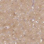 CAP2 Antibody in Immunohistochemistry (IHC)