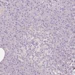 CAP2 Antibody in Immunohistochemistry (IHC)