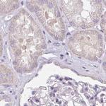 CAP2 Antibody in Immunohistochemistry (IHC)