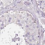 CAP2 Antibody in Immunohistochemistry (IHC)