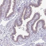 SKIV2L Antibody in Immunohistochemistry (IHC)