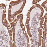 GOSR2 Antibody in Immunohistochemistry (IHC)