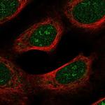 Spectrin beta-4 Antibody in Immunocytochemistry (ICC/IF)