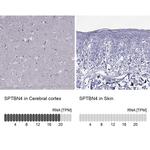 Spectrin beta-4 Antibody