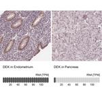 DEK Antibody in Immunohistochemistry (IHC)