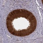 GSS Antibody in Immunohistochemistry (IHC)