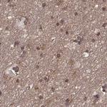 GSS Antibody in Immunohistochemistry (IHC)