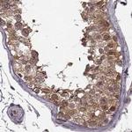 GSS Antibody in Immunohistochemistry (IHC)