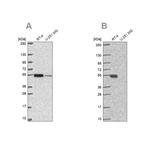 GSS Antibody in Western Blot (WB)