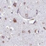 RPS15 Antibody in Immunohistochemistry (IHC)