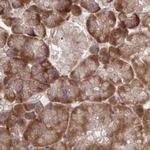 RPS15 Antibody in Immunohistochemistry (IHC)