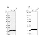 RPS15 Antibody in Western Blot (WB)